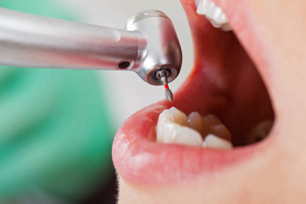 Best Emergency Dentist for Knocked-Out Tooth in Las Campanas, NM